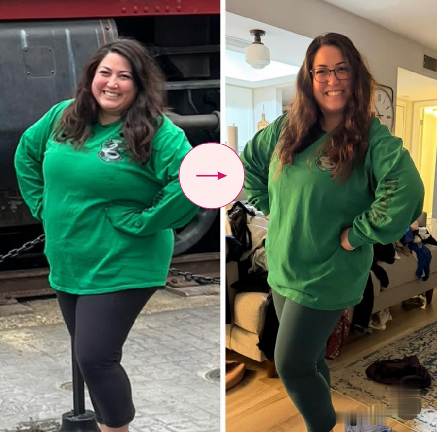Nurse down 45 lbs in under a year, before on the left and after on the right